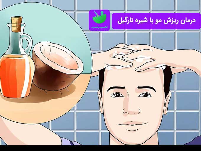 درمان ریزش مو با شیره نارگیل