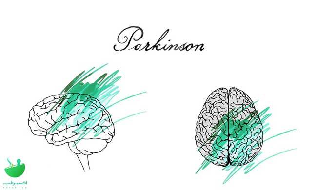 Parkinson's treatment
